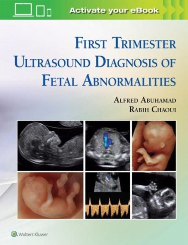 Cover Art for 9781451193725, Atlas of Ultrasound Anatomy in Late First Trimester by Abuhamad
