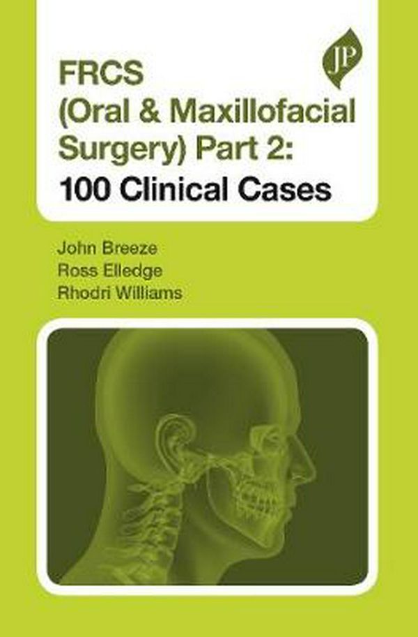 Cover Art for 9781909836839, FRCS (Oral & Maxillofacial Surgery) Part 2: 100 Clinical Cases (Postgraduate) by John Breeze, Ross Elledge, Rhodri Williams