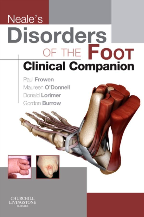 Cover Art for 9780702031717, Neale's Disorders of the Foot by Paul Frowen