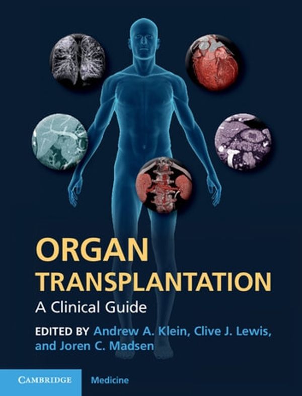 Cover Art for 9781139097451, Organ Transplantation by Andrew A. Klein, Clive J. Lewis, Joren C. Madsen