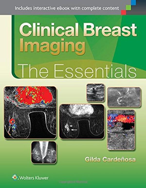 Cover Art for 9781451151770, Breast Imaging: The Essentials by Gilda Cardenosa MD  FACR