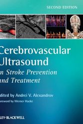 Cover Art for 9781405195768, Cerebrovascular Ultrasound in Stroke Prevention and Treatment by Alexandrov