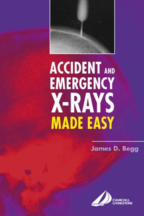 Cover Art for 9780443073243, Accident & Emerg Xrays Made Easy by Begg