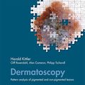 Cover Art for 9783990305751, Dermatoscopy by Harald Kittler, Cliff Rosendahl, Alan Cameron