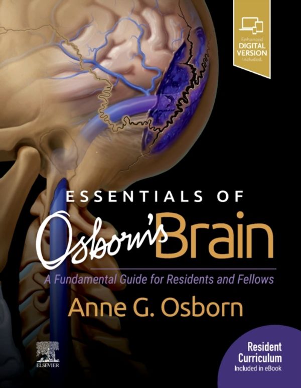 Cover Art for 9780323713207, Essentials of Osborn's Brain: A Fundamental Guide for Residents and Fellows by Anne G. Osborn