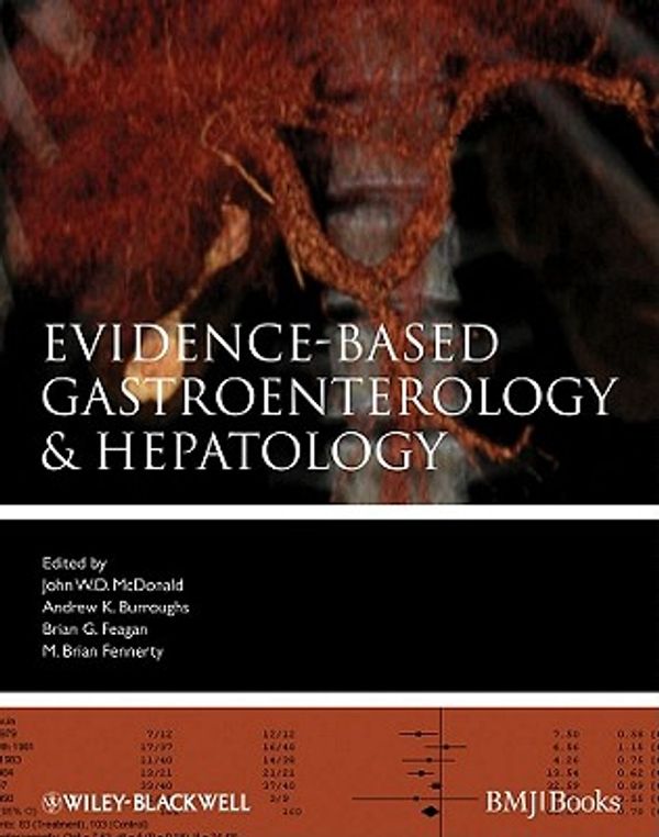 Cover Art for 9781444314410, Evidence-Based Gastroenterology and Hepatology by John W. D. McDonald, Andrew K. Burroughs, Brian G. Feagan, M. Brian Fennerty