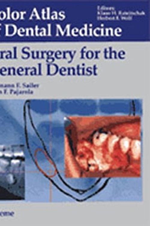 Cover Art for 9783131082411, Oral Surgery for the General Dentist by Hermann Sailer