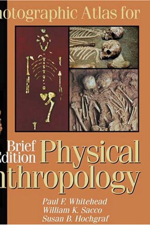 Cover Art for 9780895826688, A Photographic Atlas for Physical Anthropology by Paul F. Whitehead
