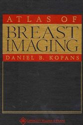 Cover Art for 9780781717205, Atlas of Breast Imaging by Daniel B. Kopans