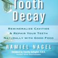 Cover Art for 9780982021354, Cure Tooth Decay by Ramiel Nagel