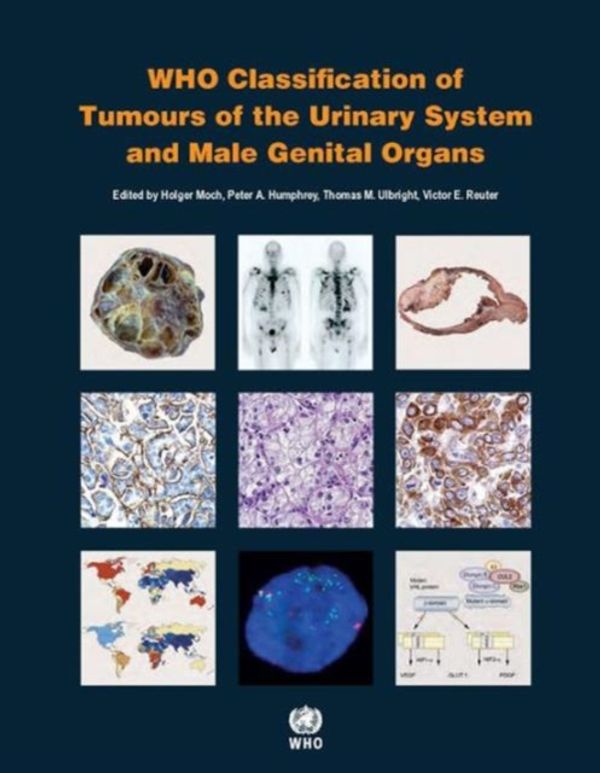 Cover Art for 9789283224372, Who Classification of Tumours of the Urinary System and Male Genital OrgansIARC Who Classification of Tumours by International Agency for Research on Cancer