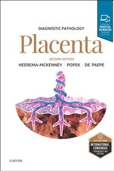 Cover Art for 9780323609715, Diagnostic Pathology: Placenta, 2e by Amy Heerema-McKenney MD