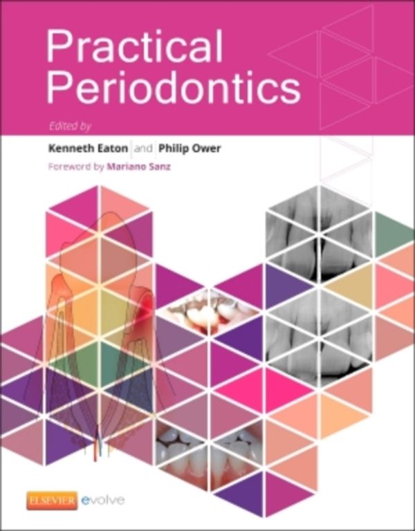Cover Art for 9780702043574, Churchill's Textbook of Periodontics, 1e by Ken A. Eaton