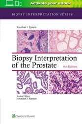 Cover Art for 9781975136543, Biopsy Interpretation of the Prostate by Jonathan I. Epstein
