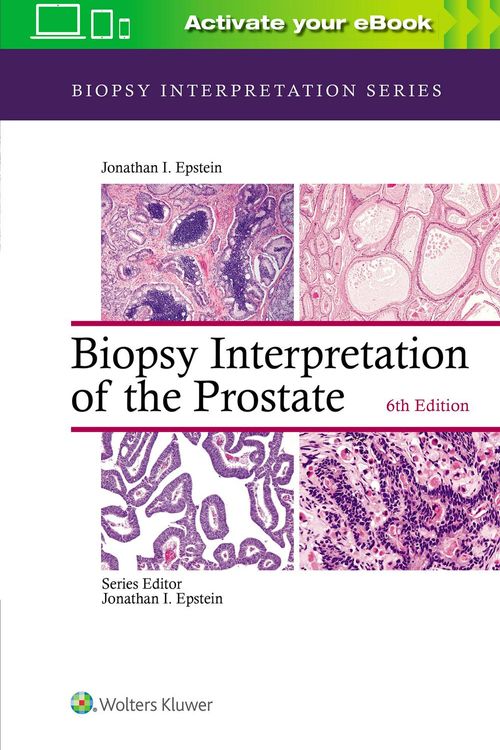 Cover Art for 9781975136543, Biopsy Interpretation of the Prostate by Jonathan I. Epstein