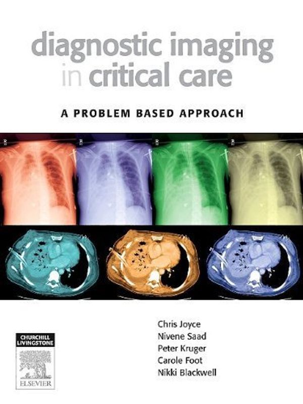 Cover Art for B009O5A06G, Diagnostic Imaging in Critical Care: A Problem Based Approach, 1e Pap/Cdr edition by Joyce MB ChB JFICM FANZCA, Chris, Saad MB ChB FRANZCR, published by Churchill Livingstone (2009) [Paperback] by 