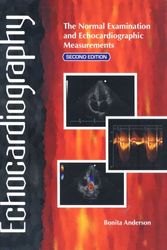 Cover Art for 9780646468631, Echocardiography by Bonita Anderson