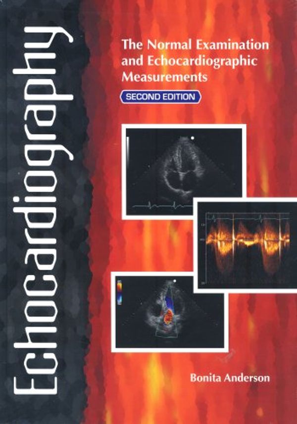 Cover Art for 9780646468631, Echocardiography by Bonita Anderson