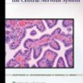 Cover Art for 9781469879703, Biopsy Interpretation of the Central Nervous System by Matthew Schniederjan