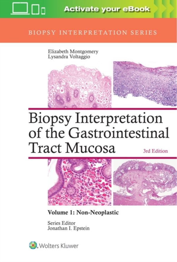 Cover Art for 9781496337276, Biopsy Interpretation of the Gastrointestinal Tract Mucosa: Nonneoplastic: 1 by Elizabeth A. Montgomery MD