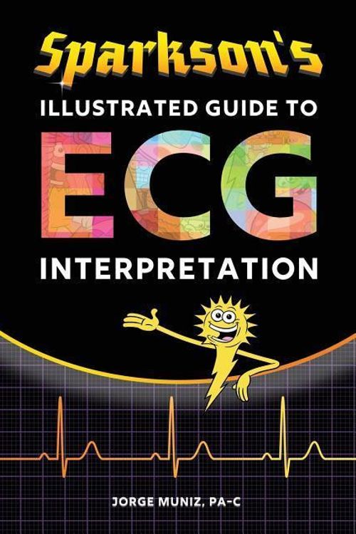 Cover Art for 9780996651318, Sparkson's Illustrated Guide to ECG Interpretation by Jorge Muniz
