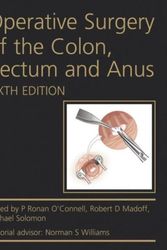 Cover Art for 9780340991275, Operative Surgery of the Colon, Rectum and Anus by O'Connell, P. Ronan, Robert D. Madoff, Michael Solomon