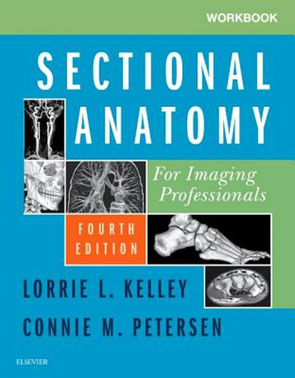 Cover Art for 9780323569613, Workbook for Sectional Anatomy for Imaging Professionals, 4e by Kelley MS RT(R), Lorrie L.