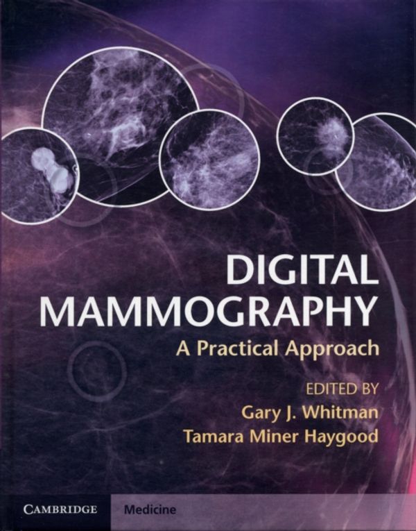 Cover Art for 9780521763721, Digital Mammography by Gary J. Whitman
