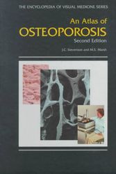 Cover Art for 9781850709879, An Atlas of Osteoporosis, Second Edition by John C. Stevenson