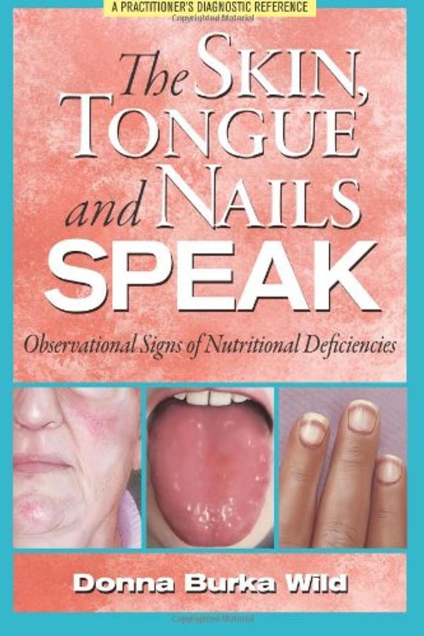 Cover Art for 9780615601212, The Skin, Tongue and Nails Speak: Observational Signs of Nutritional Deficiencies by Donna Burka Wild