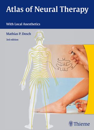 Cover Art for 9783131660237, Altas of Neural Therapy with Local Anesthetics by Mathias Dosch