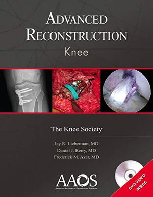 Cover Art for B07GZWZ41D, Advanced Reconstruction: Knee by Jay R. Lieberman