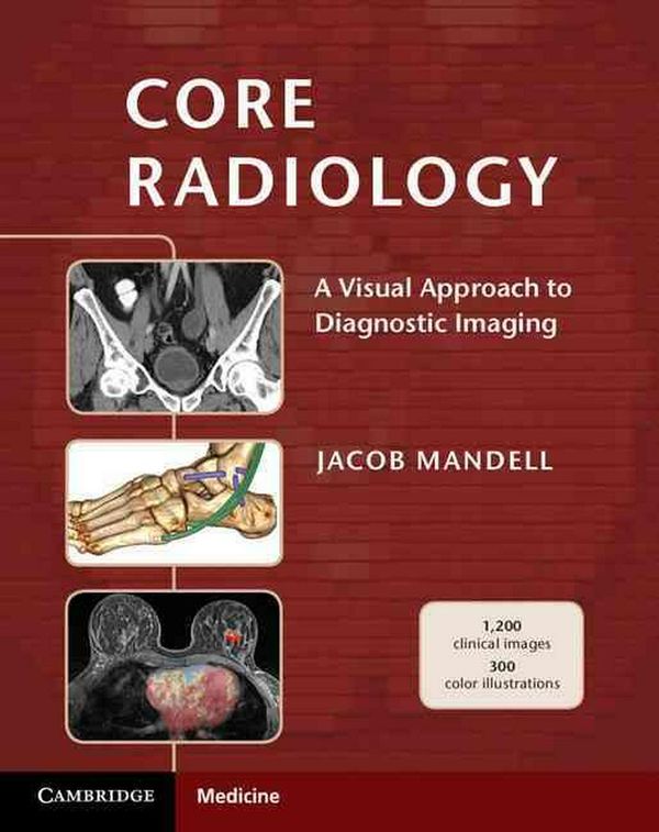Cover Art for 9781107679689, Core Radiology by Jacob Mandell