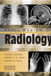 Cover Art for 9781840766394, Rapid Review of Radiology by Shahid Hussain, Sherif Aaron Abdel Latif, Adrian David Hall