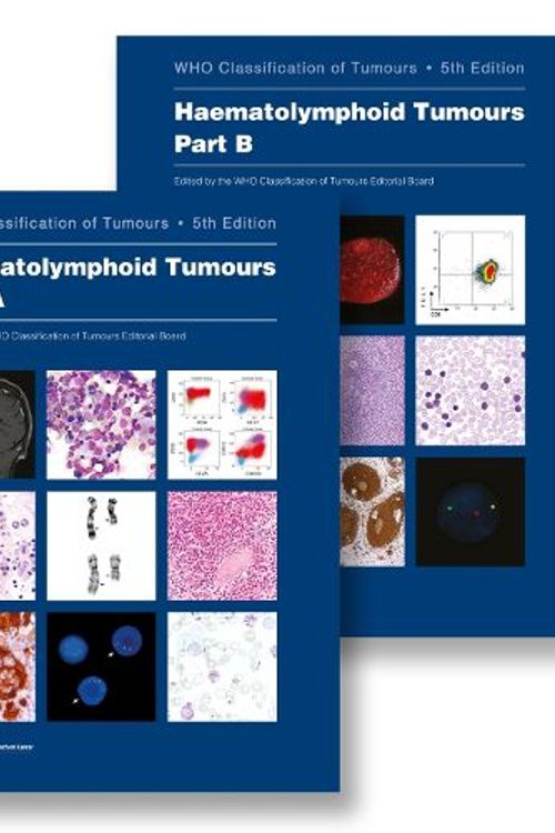 Cover Art for 9789283245209, Haematolymphoid Tumours: Who Classification of Tumours by UK Government